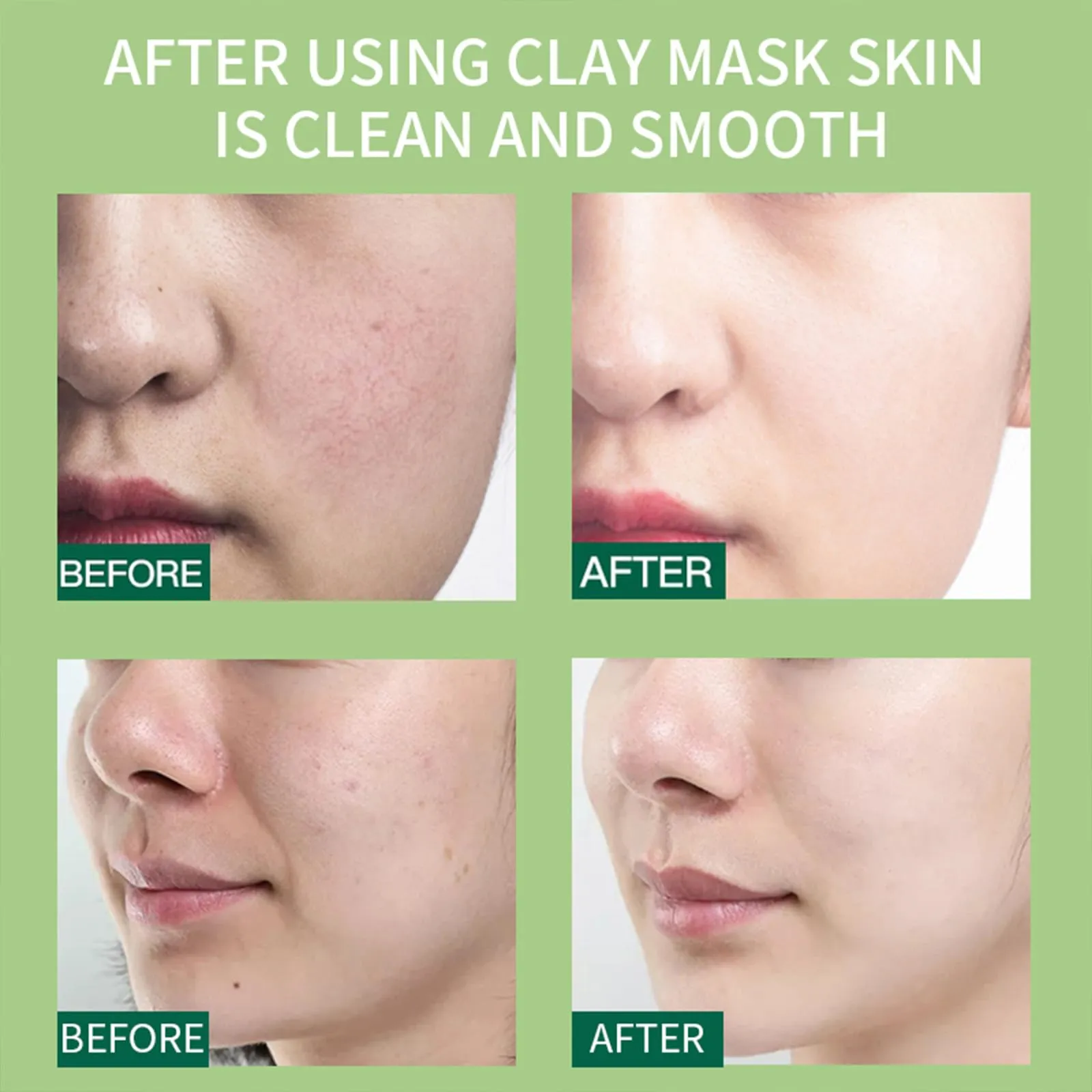 10 Pods Clay Facial Mask Set - Rose, Green Tea, Eggplant, Avocado, Dead Sea Mud, Mud Mask Deep Pore Cleansing Acne Blackhead Removal Men & Women Face Mask Skin Care,Two To Three Times A Week.