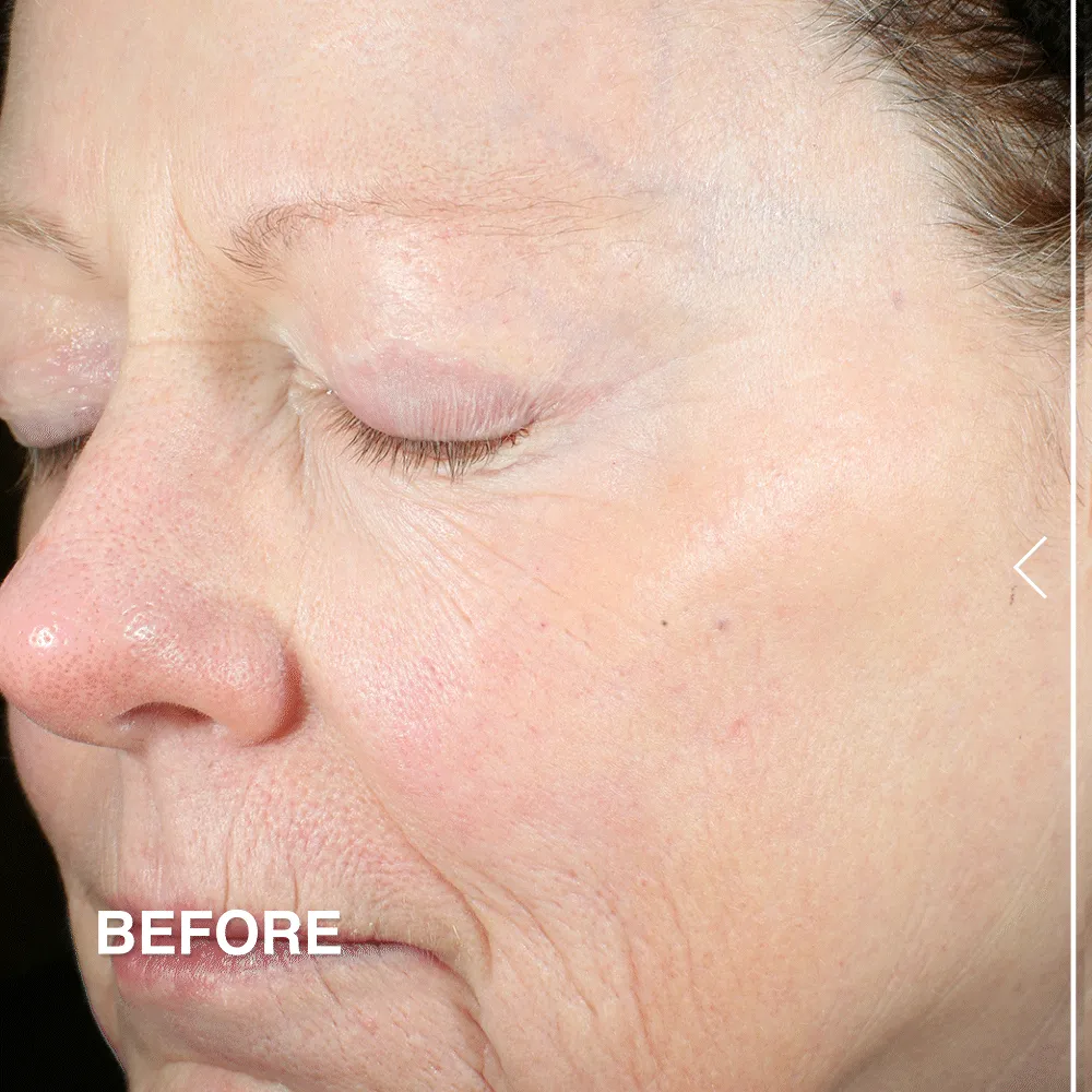 Advanced Peptides & Flora-Collagen™ Eye Cream