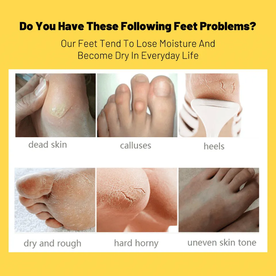 Aichun Beauty Banana Foot Peeling Mask - 40g