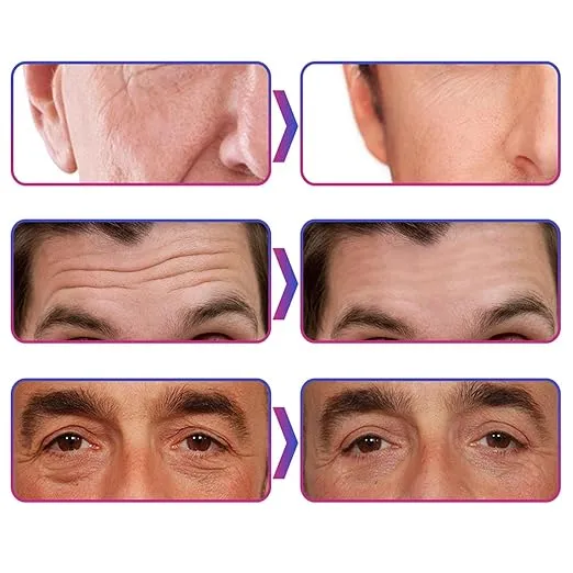 Anti-Aging And Anti Wrinkle Cream for Men [Pack of 2]