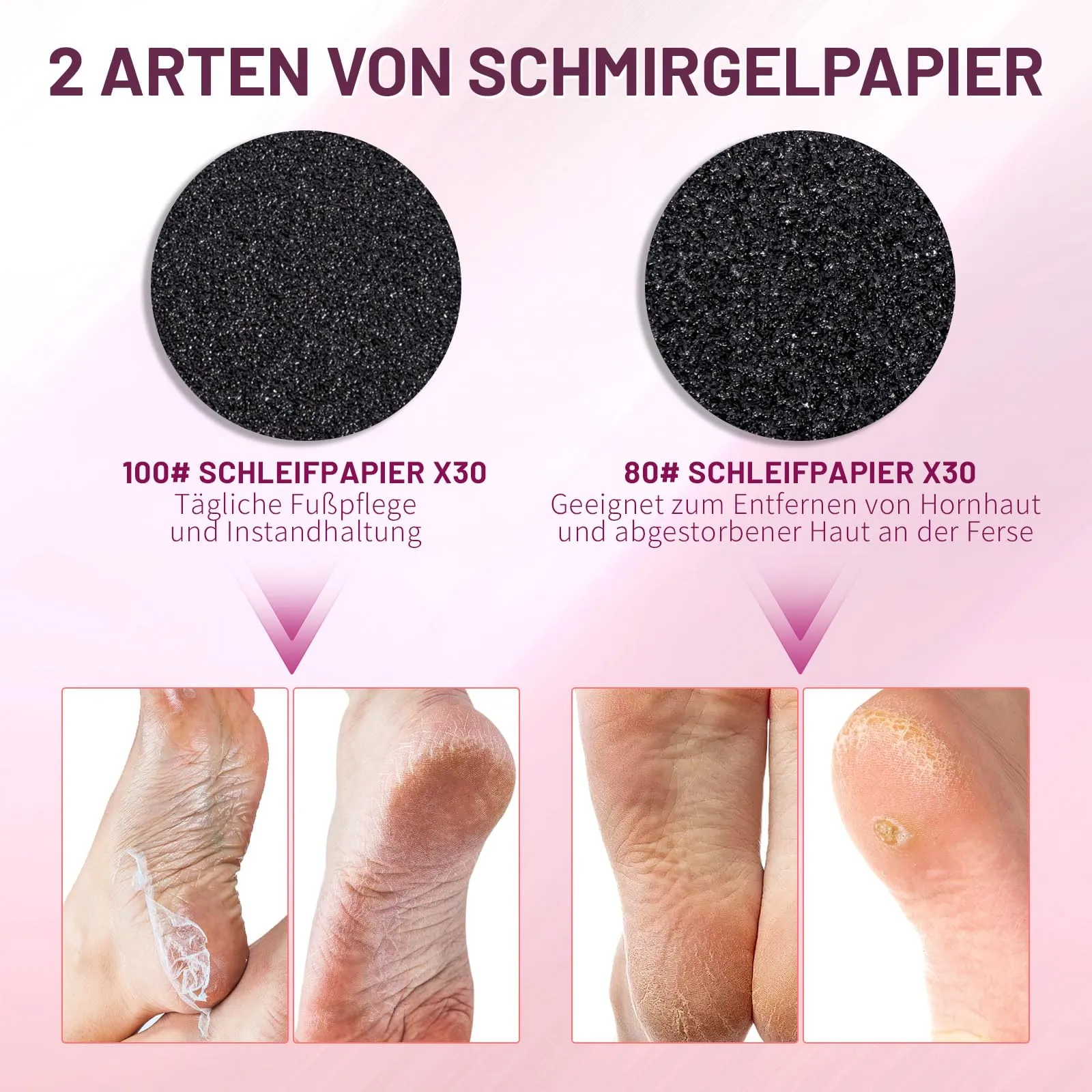AORAEM Electric Callus Remover, Adjustable Speed Pedicure Set, Professional Callus Removal Foot for Dead Skin Dry Skin Cracked Heels Calluses, with 60 Replacement Sanding Pads