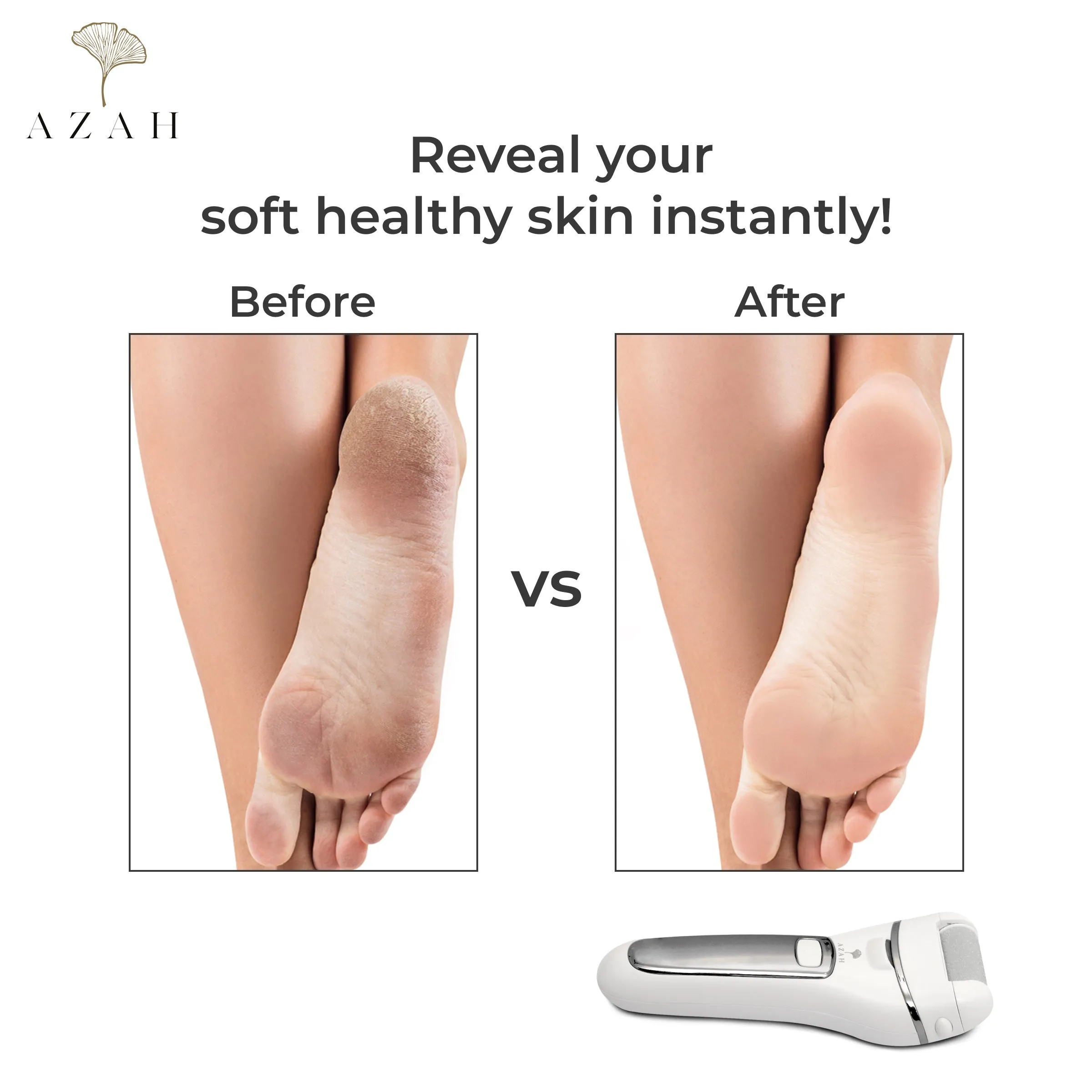 Azah Electric Callus Remover