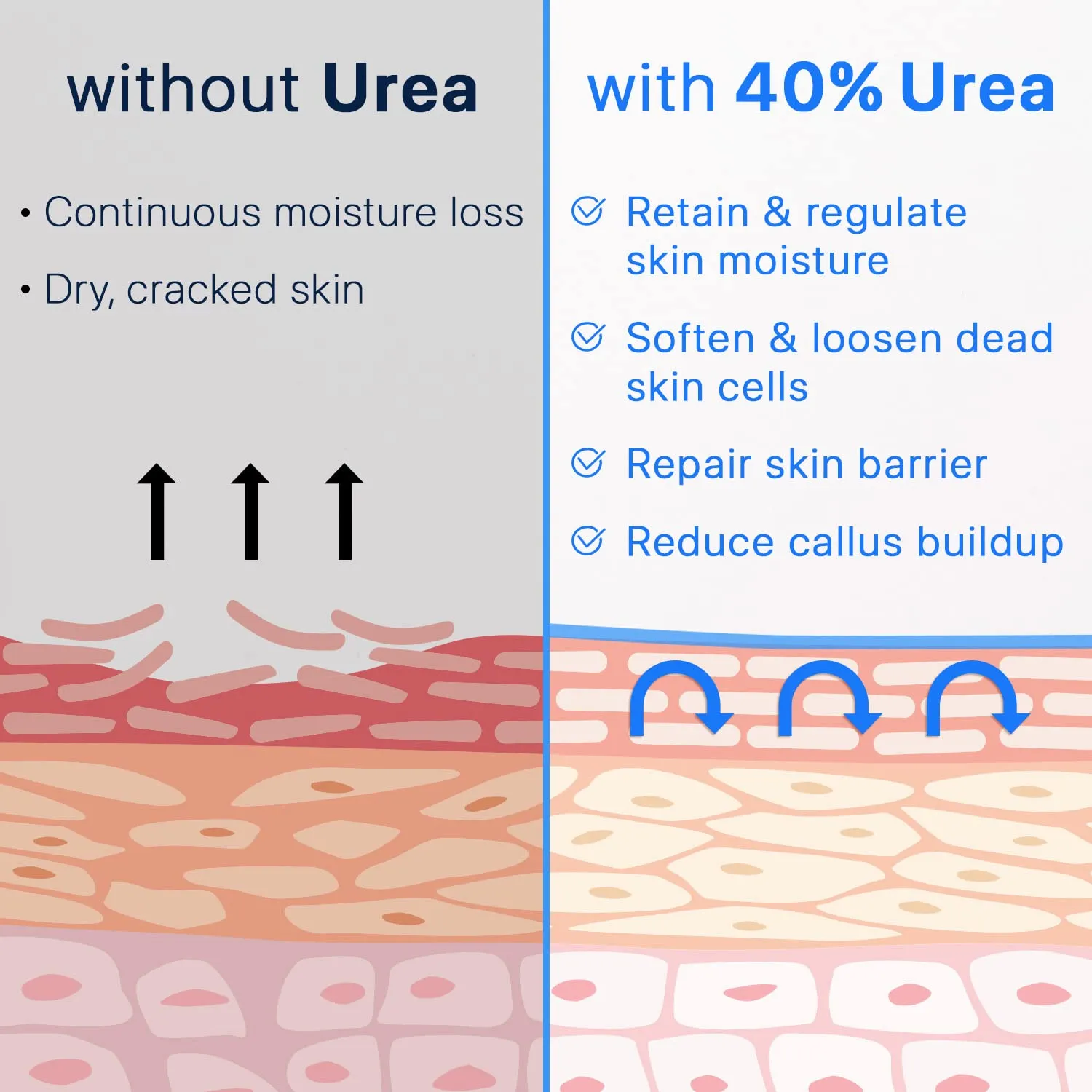 Ebanel Urea Cream 40% plus Salicylic Acid 2%, Foot Cream for Dry Cracked Heels Feet Knees Elbows Hands, Foot Dead Skin Cuticle Callus Remover Toenail Softener, Skin Barrier Repair Cream, 2-Pack