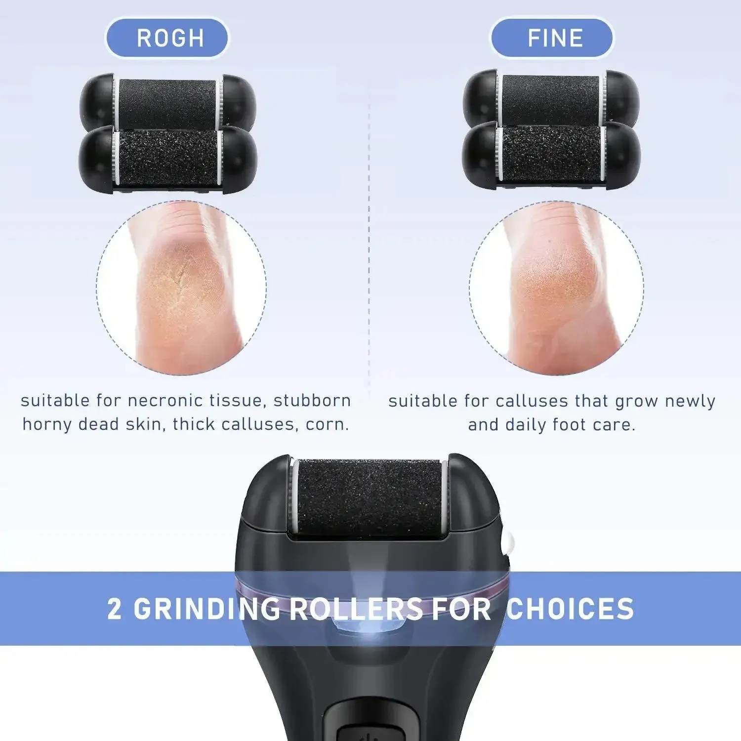 Electric Callus Remover