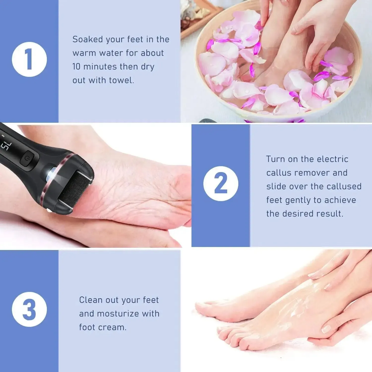Electric Callus Remover