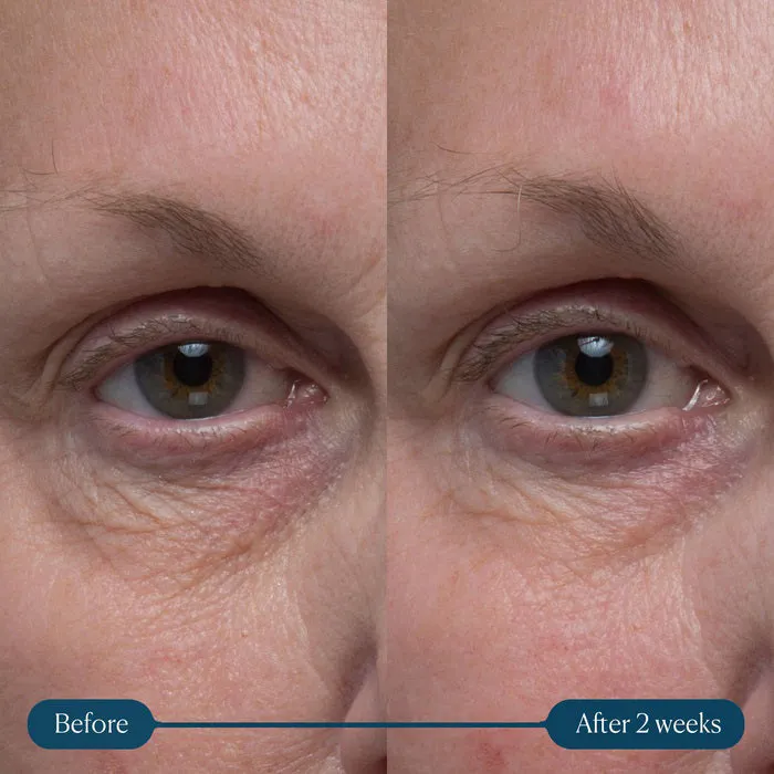 ELEMIS - PRO-COLLAGEN VITALITY EYE CREAM