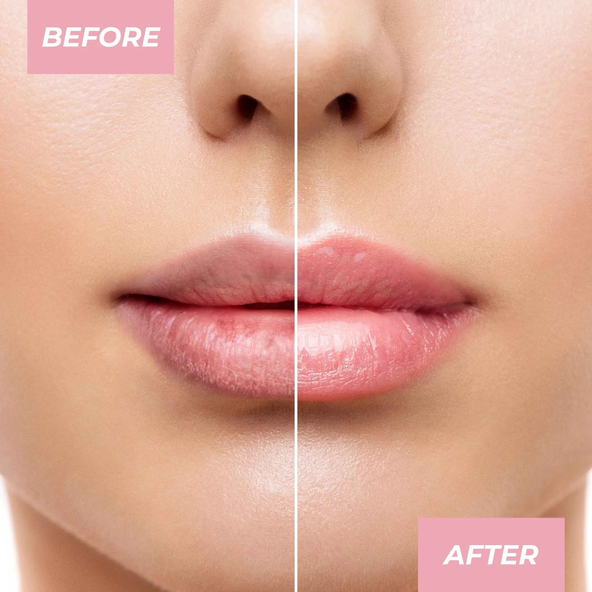 Glow Up PH Lip Balm