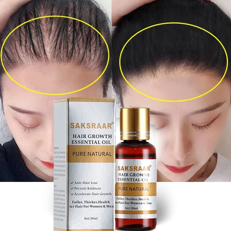 Hair Care Hair Growth Essential Oils Essence