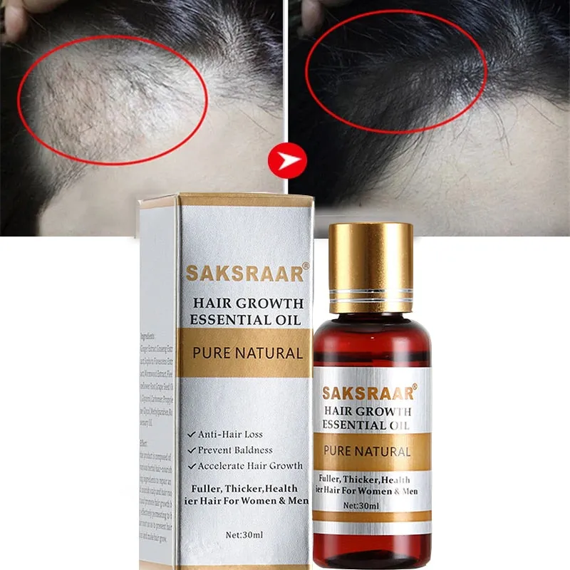 Hair Care Hair Growth Essential Oils Essence