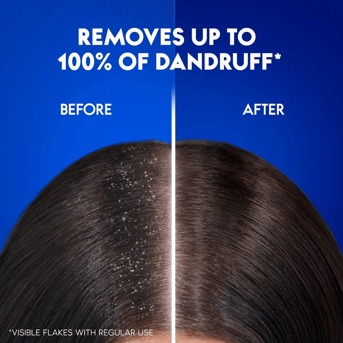 Head & Shoulders Charcoal Detox Shampoo - 700ml   400ml