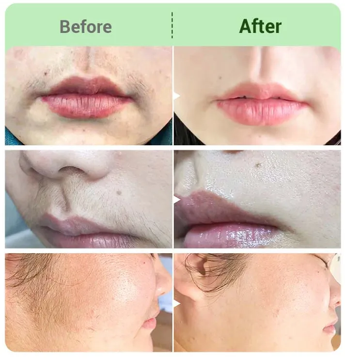 ⏳Hot Promotion 49% OFF⏳Hair Removal Cream Kit for Women💛