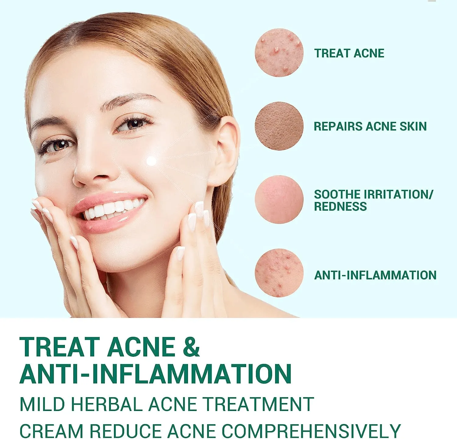 Lanbena Anti Acne Solution Gel - 20g