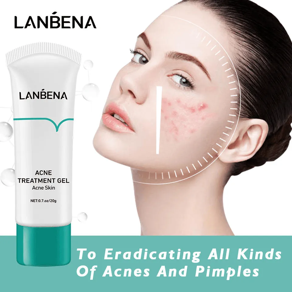 Lanbena Anti Acne Solution Gel - 20g