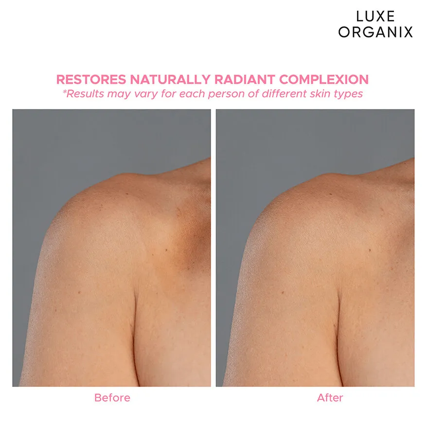 Luxe Organix Niacinamide   Arbutin Healthy Light Whitening Serum Lotion - 350ml