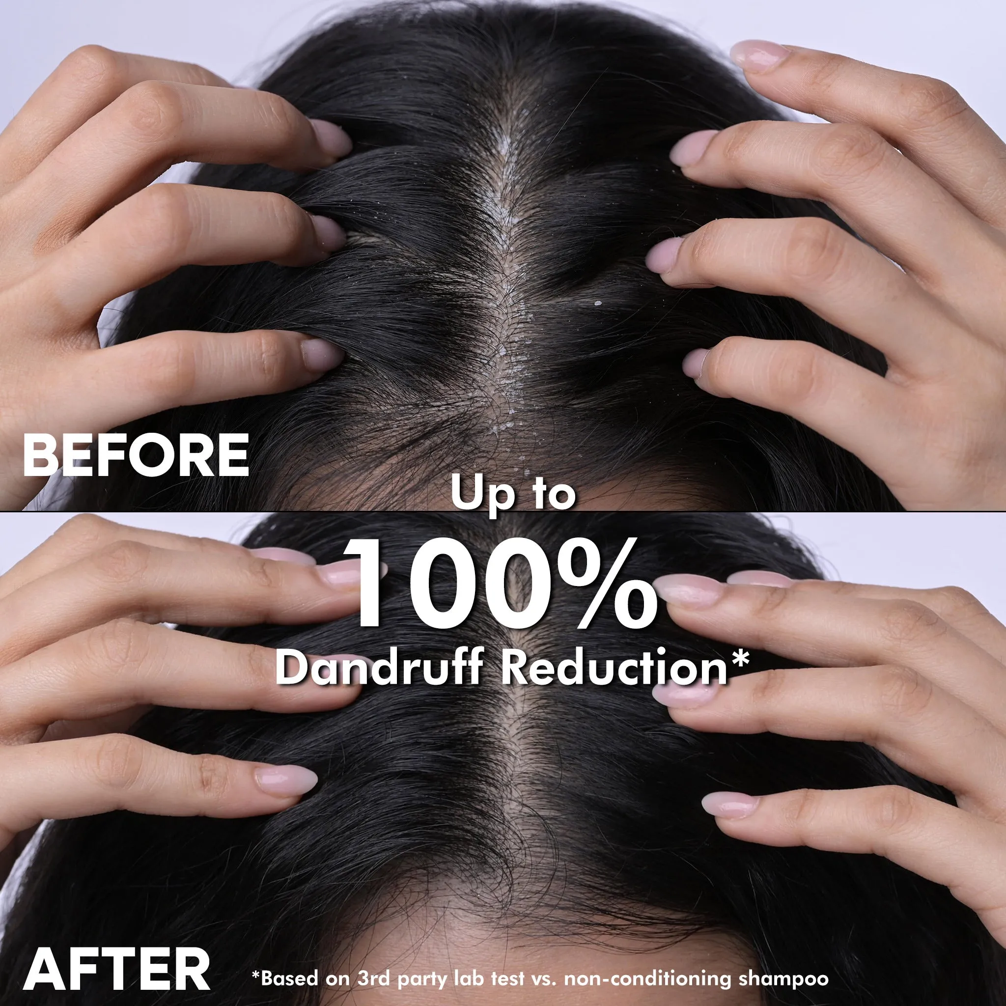 Naturali Dandruff Defence Shampoo with Cactus and Tea Tree Oil