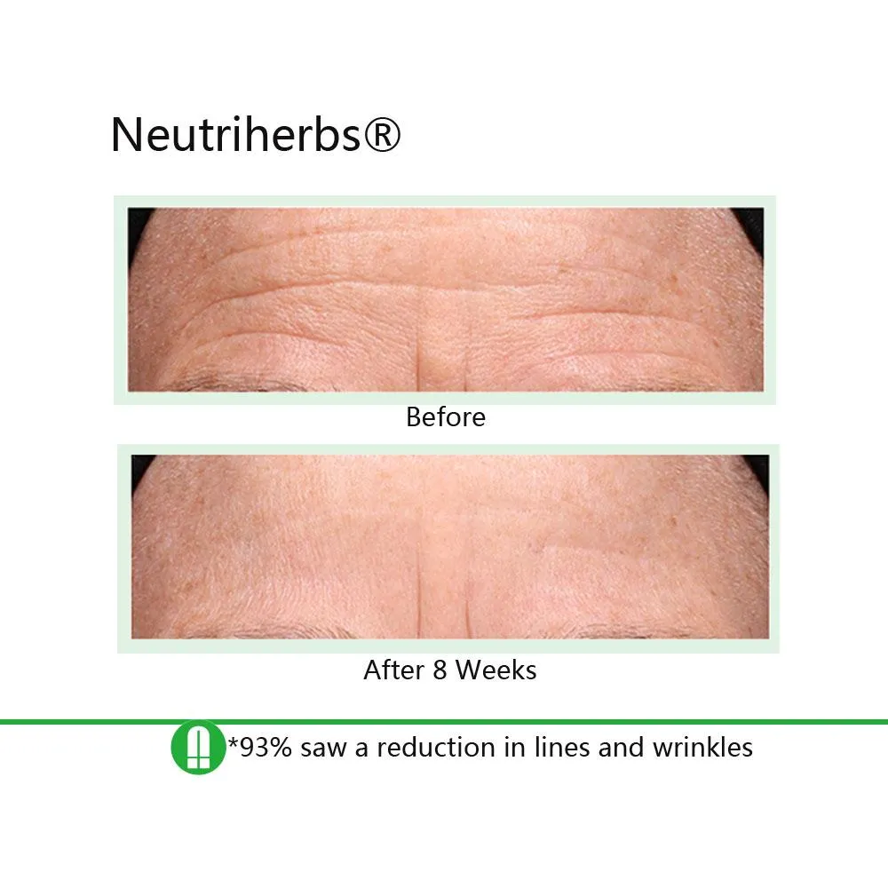 Neutriherbs | Powerful Anti Aging Set For Fine Lines Wrinkles