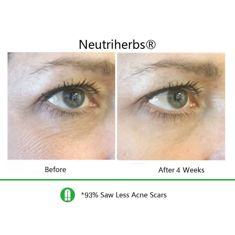 Neutriherbs | Powerful Anti Aging Set For Fine Lines Wrinkles