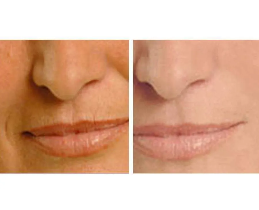 Night Repair Cream   Vitamin C  Serum