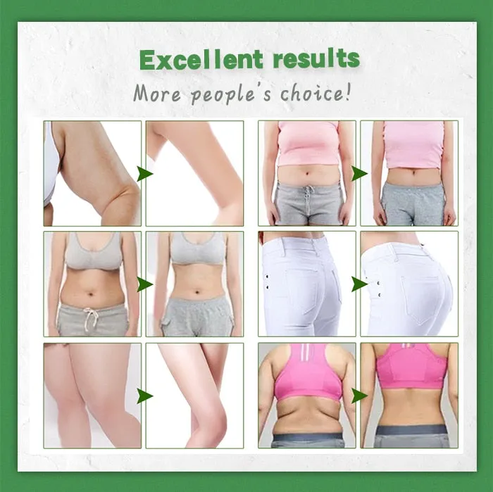 OILYOUNG Slimming Body Cream Weight Lose Body Anti Winkles Firming And Delicate Skin Shaping Slim Curves Whitening Cream 35g