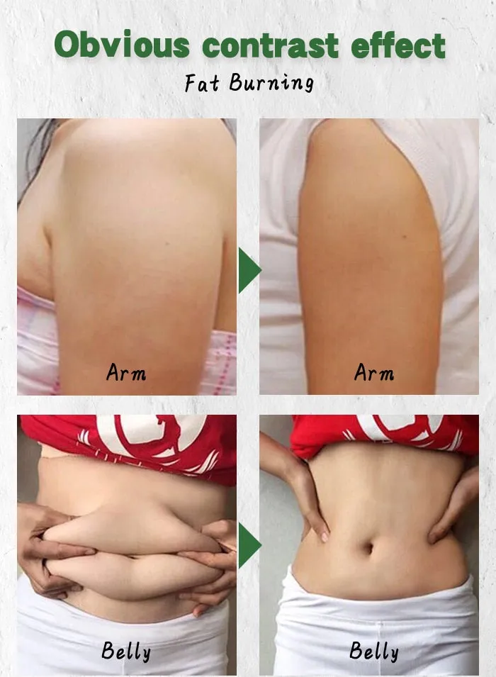 OILYOUNG Slimming Body Cream Weight Lose Body Anti Winkles Firming And Delicate Skin Shaping Slim Curves Whitening Cream 35g