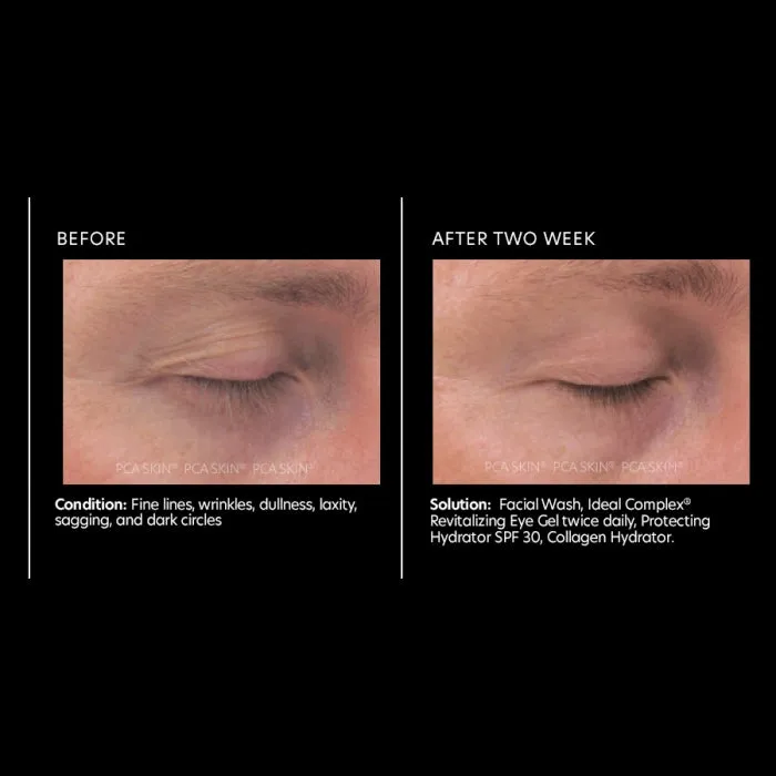 PCA Ideal Complex Restorative Eye Cream