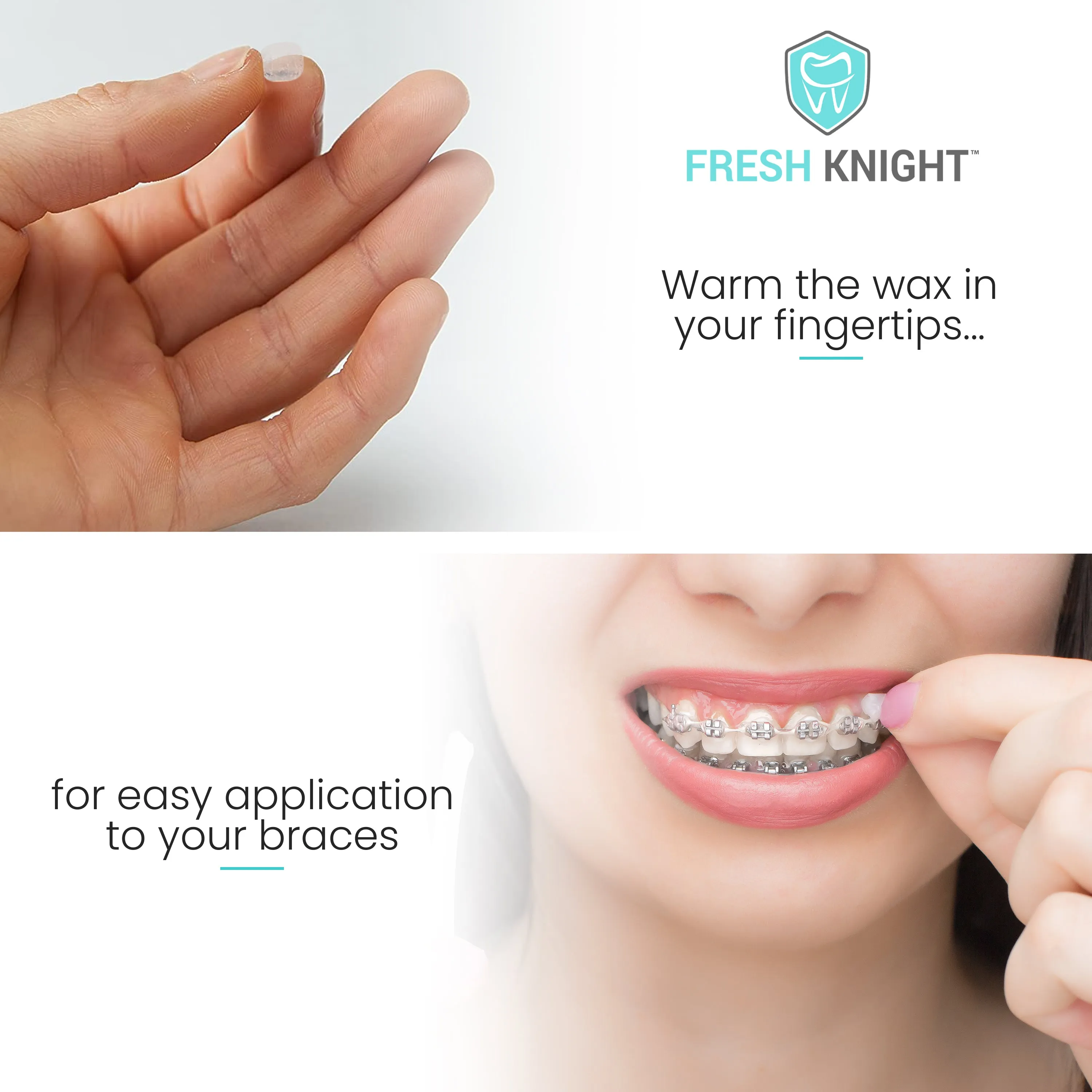 Premium Braces Wax- 10 pack with FREE storage case.