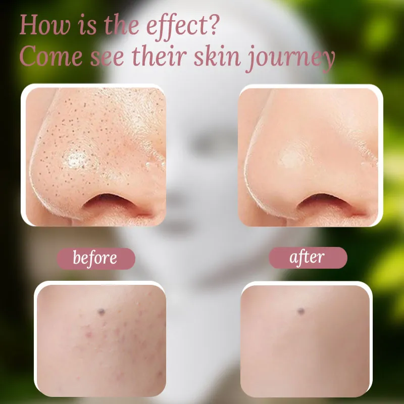 Red Light Therapy for Face