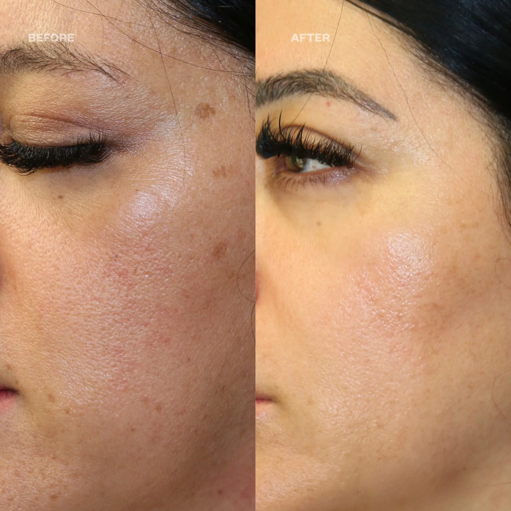 RETINOL STAGING™ REGIMEN