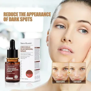 Scar Removal Moisturizer