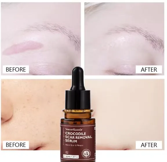 Scar Removal Moisturizer