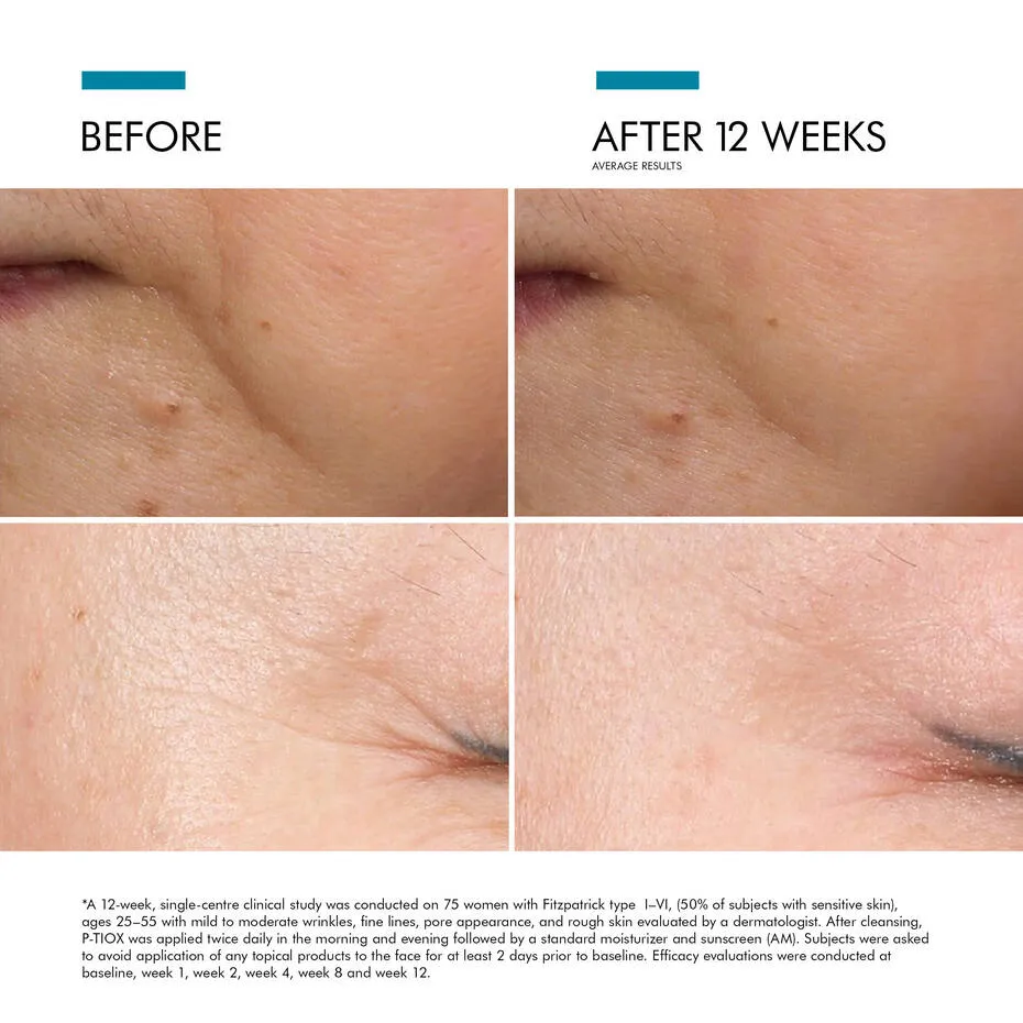 SkinCeuticals P-Tiox