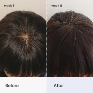 Superpower Advanced Hair & Scalp Serum