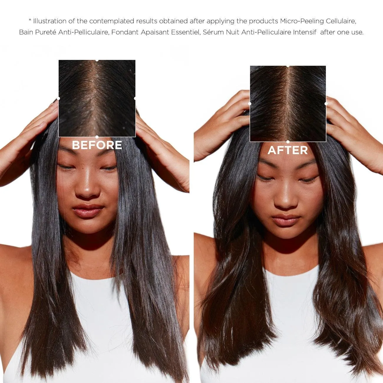 Symbiose Purifying Anti-Dandruff Shampoo