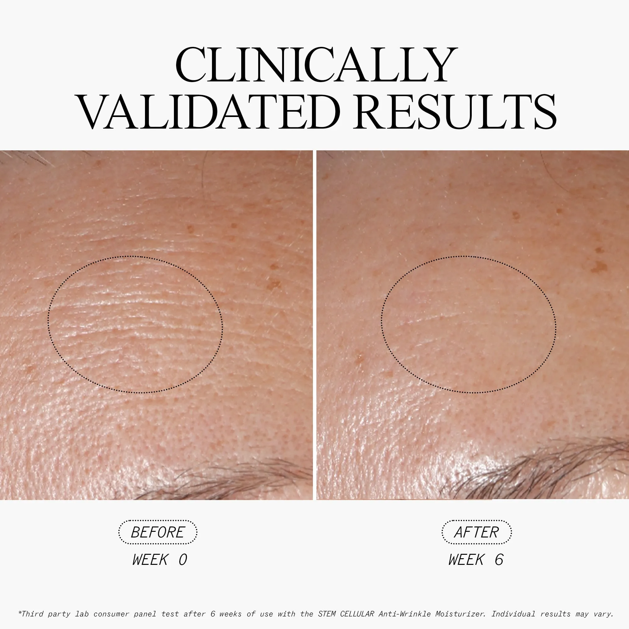 The Power of Three, Overnight Anti-Wrinkle Dream Team
