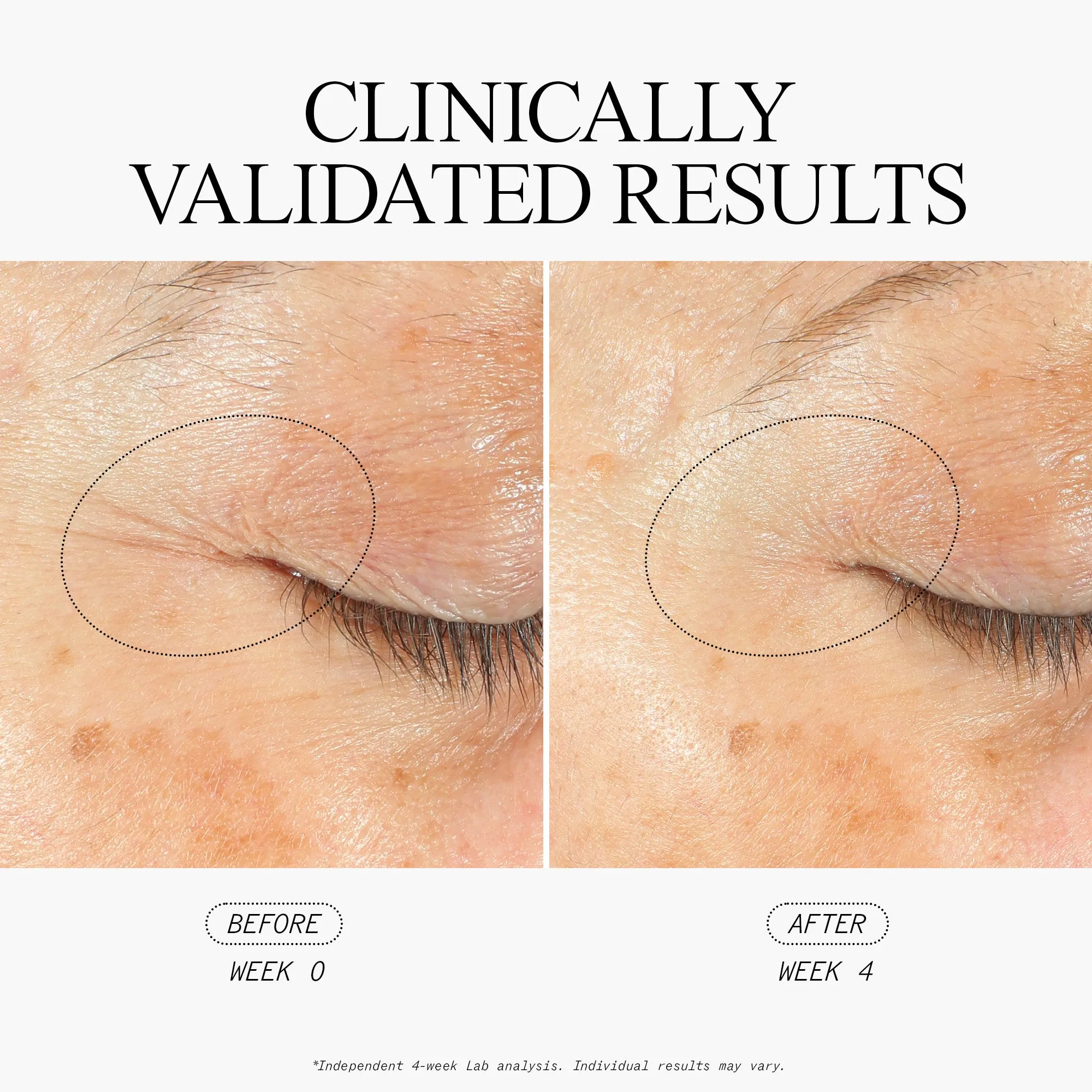 The Power of Three, Overnight Anti-Wrinkle Dream Team