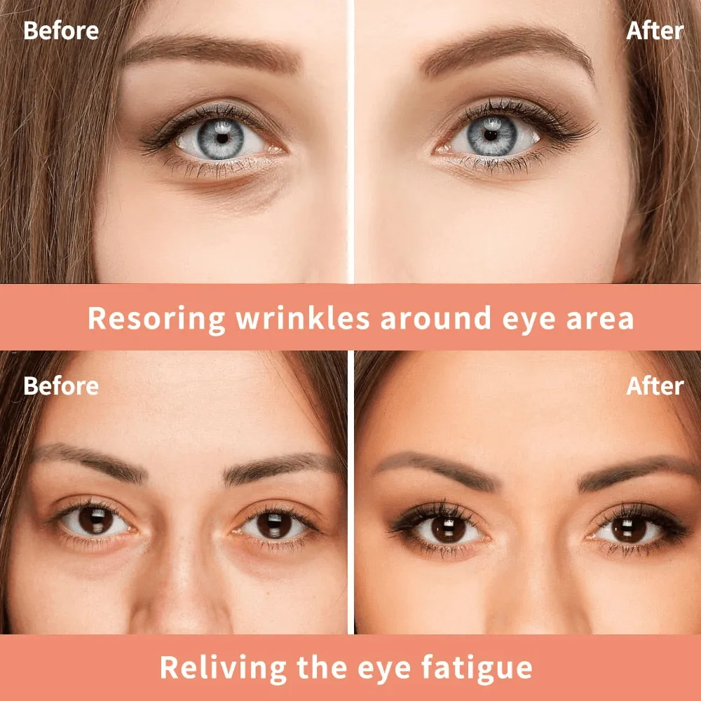 Vibrant Glamour Cayman Repair & Treatment Eye Cream - 20g