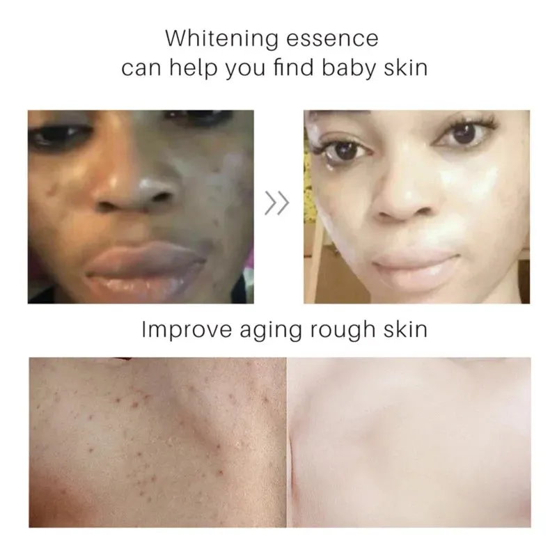 Vita-C-Turmeric Body Lightening Lotion 100ml /3.3 oz.